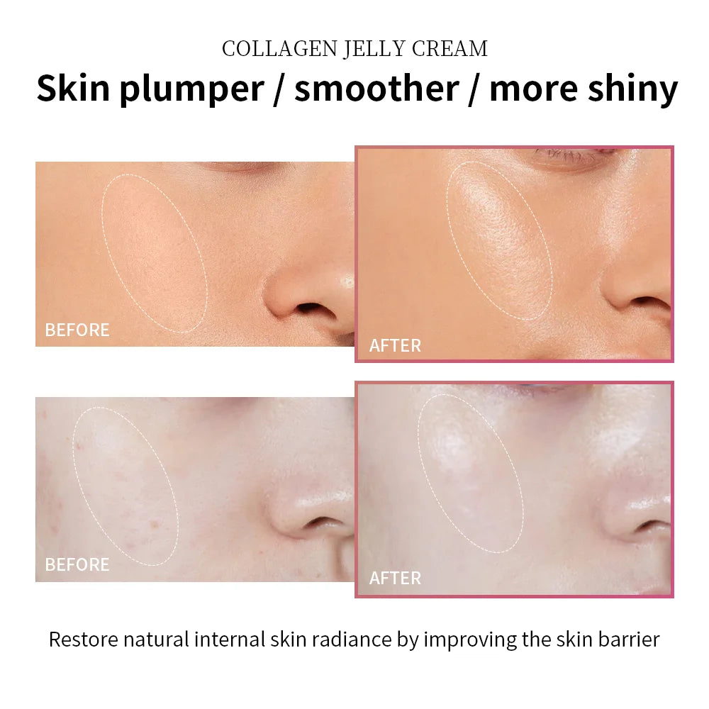 Lakerain Collagen Jelly Face Cream – Niacinamide Moisturizer for Firming & Glowing Skin